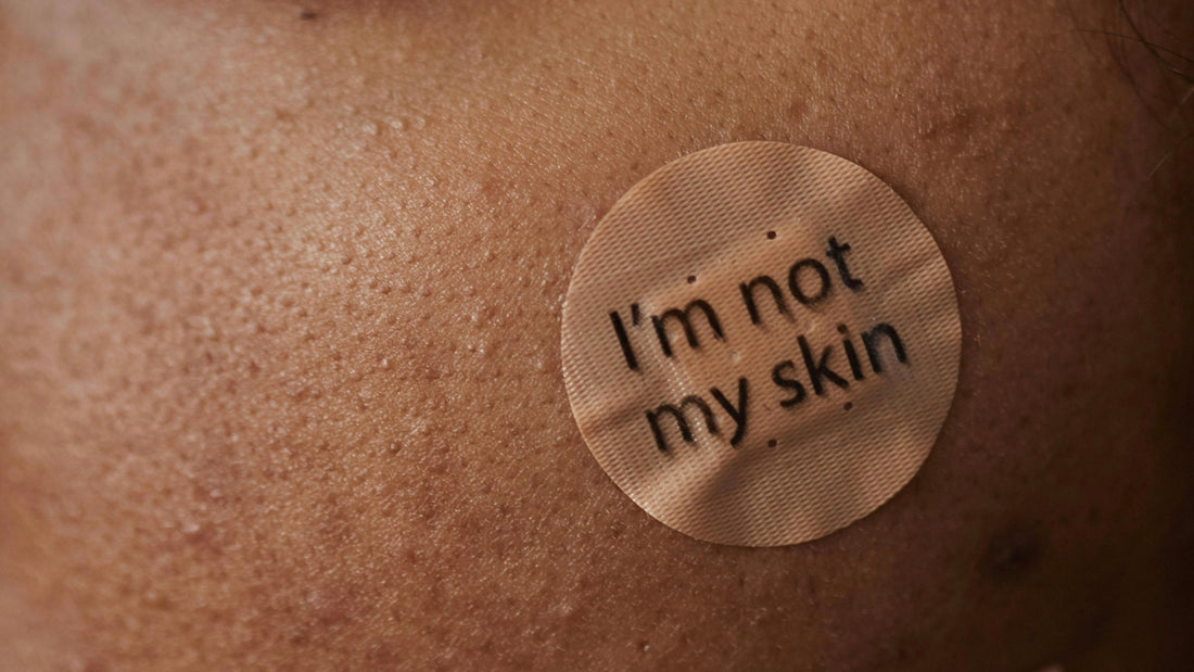 Skin Dysmorphia | Blend Skin | Australian Skincare